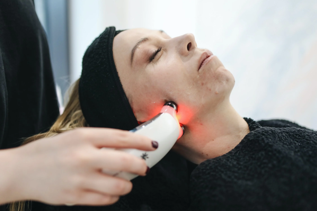 What are the Benefits of Laser Treatment for Acne Scars?